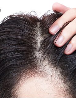 dầu gội đầu nam chống rụng tóc
